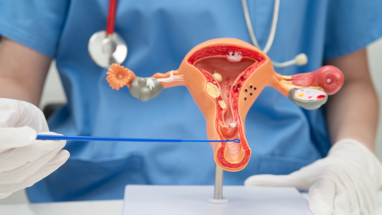 Vaginal yeast infection (Credits: Canva)
